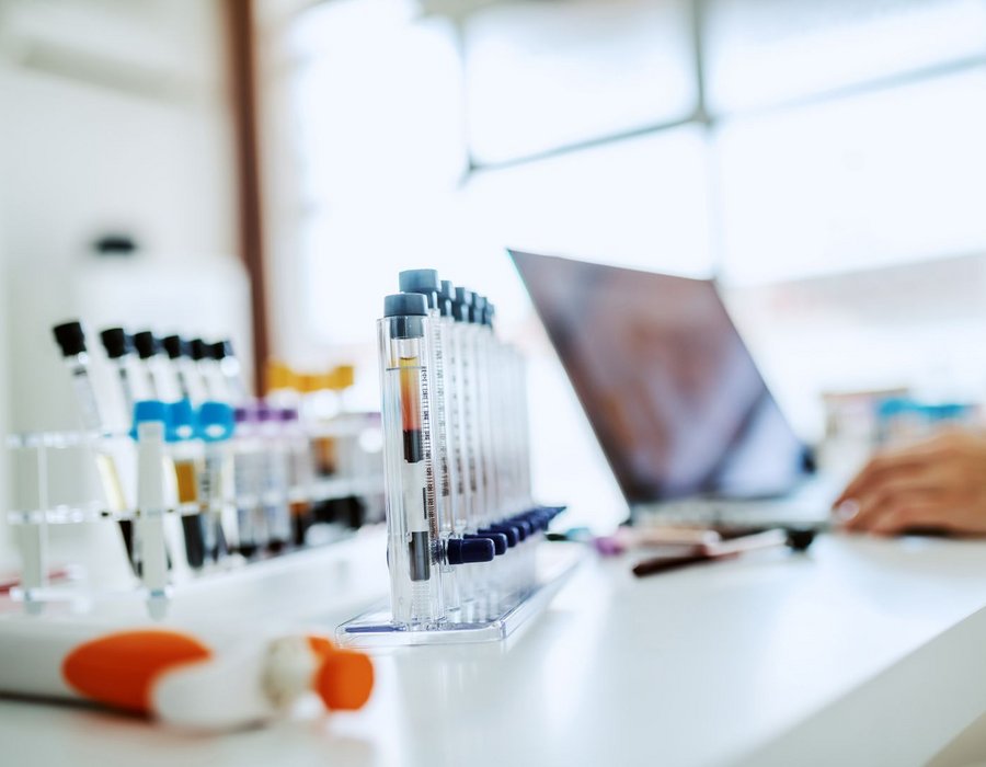 Leistungsstudien nach IVDR: Evidenzstrategie, Statistik und Reporting Leistungsstudien nach IVDR: Evidenzstrategie, Statistik und Reporting