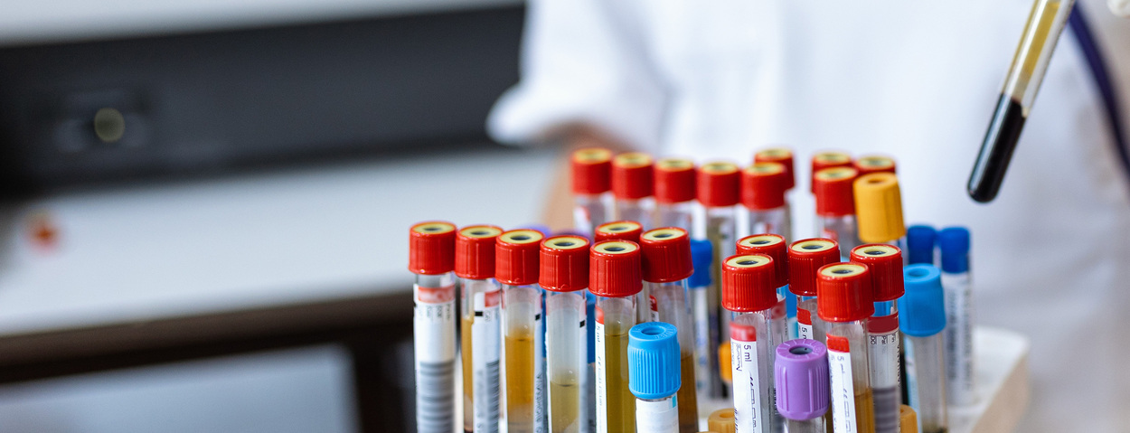 In-vitro-Diagnostika Essentials: Europäische Verordnung über In-vitro-Diagnostik (EU) 2017/746
