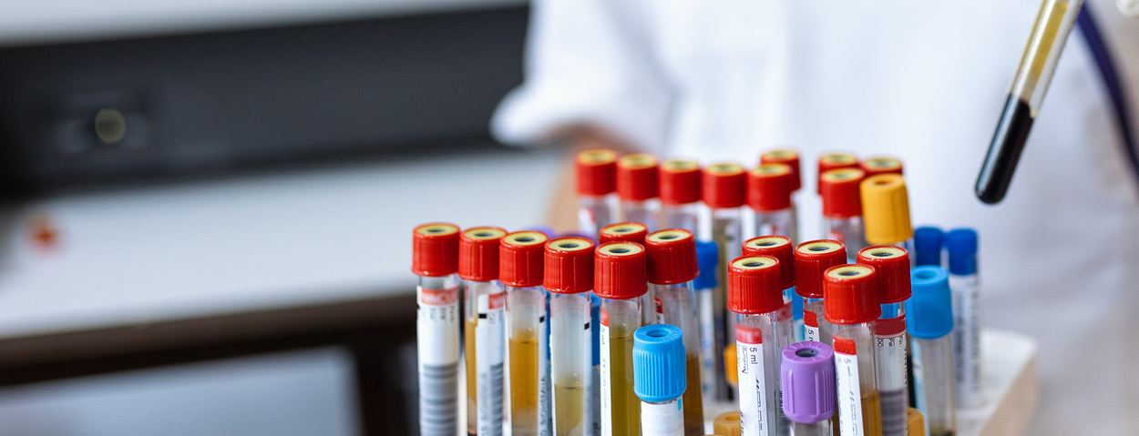 In-vitro-Diagnostika Essentials: Combination Tests und Near-Patient-Testing